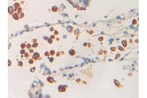 Detection of PLA1 in Human Lung Tissue using Polyclonal Antibody to Phospholipase A1 (PLA1) (PLA1A antibody  (AA 309-452))