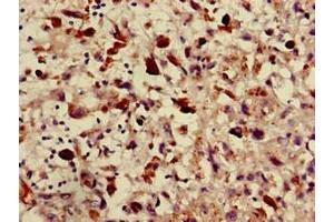 ABCA2 antibody  (AA 1223-1429)
