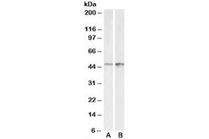Western blot testing of A431 [A] and HeLa [B] lysates with E2F4 antibody at 0. (E2F4 antibody)