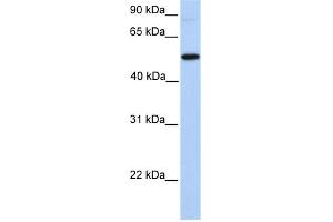 GALNT13 antibody used at 1 ug/ml to detect target protein. (GALNT13 antibody  (N-Term))