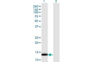 Western Blot analysis of LDOC1 expression in transfected 293T cell line by LDOC1 monoclonal antibody (M13), clone 3E5. (LDOC1 antibody  (AA 1-146))
