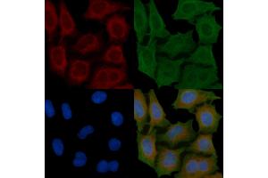 ABIN6260985 and ABIN6266912 staining Hela cells(45 min of heat-shock) by IF/ICC.