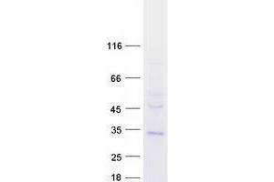 Validation with Western Blot (TMEM38B Protein (Myc-DYKDDDDK Tag))