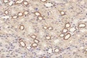 Immunohistochemistry analysis of paraffin-embedded mouse kidney using,RPL10 (ABIN7075428) at dilution of 1: 4000
