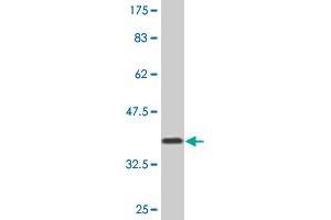 Western Blot detection against Immunogen (36. (FHL3 antibody  (AA 3-102))