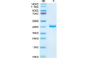Mouse TFF1 on Tris-Bis PAGE under reduced condition. (TFF1 Protein (AA 22-87) (Fc Tag))