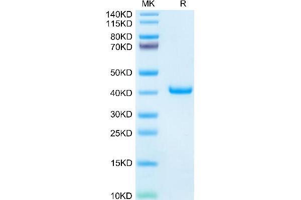 TFF1 Protein (AA 22-87) (Fc Tag)
