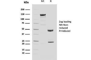 SDS-PAGE Analysis Purified MUC4 Mouse Monoclonal Antibody (MUC4/3084). (MUC4 antibody  (AA 1730-1864))