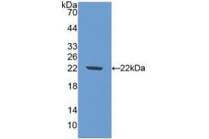 Western blot analysis of recombinant Mouse NOS1. (NOS1 antibody  (AA 53-247))