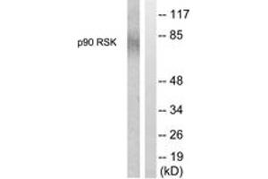 Western blot analysis of extracts from 293 cells, treated with PMA 125ng/ml 30', using p90 RSK (Ab-380) Antibody.