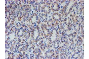 Image no. 1 for anti-Acyl-CoA Synthetase Family Member 2 (ACSF2) antibody (ABIN1496423) (ACSF2 antibody)