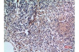 Immunohistochemistry (IHC) analysis of paraffin-embedded Human Lung, antibody was diluted at 1:100. (CD38 antibody  (Internal Region))
