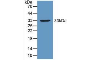 Detection of Recombinant PDHX, Mouse using Polyclonal Antibody to Pyruvate Dehydrogenase Complex Component X (PDHX) (PDHX antibody  (AA 222-471))