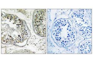 Immunohistochemistry (IHC) image for anti-Carbohydrate (Chondroitin 4) Sulfotransferase 13 (CHST13) (Internal Region) antibody (ABIN1850992) (CHST13 antibody  (Internal Region))