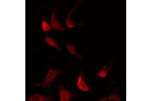 ABIN6269300 staining NIH-3T3 by IF/ICC. (SMAD3 antibody  (C-Term))