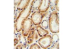 Immunohistochemistry analysis in formalin fixed and paraffin embedded human normal lung tissue reacted with GALNT5 Antibody (N-term) followed by peroxidase conjugation of the secondary antibody and DAB staining. (GALNT5 antibody  (N-Term))