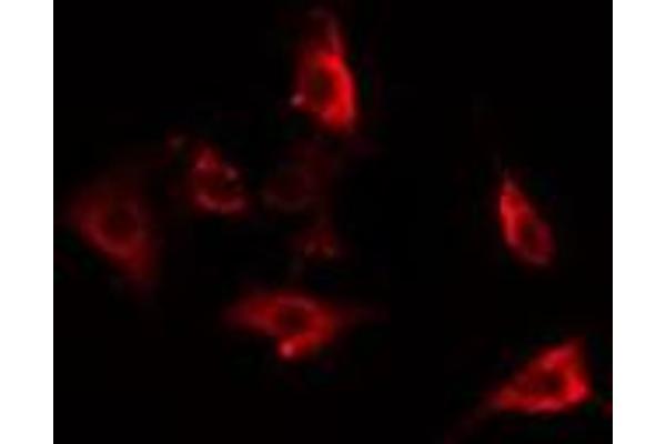 ACTBL2 antibody  (Internal Region)