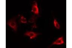 ABIN6275863 staining HepG2 cells by IF/ICC. (ACTBL2 antibody  (Internal Region))