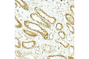 Immunohistochemistry of paraffin-embedded human kidney using IDH1 Rabbit mAb (ABIN7268027) at dilution of 1:500 (40x lens). (IDH1 antibody)
