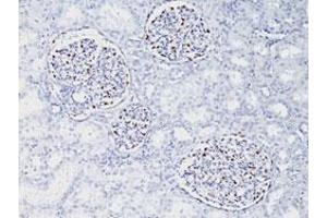 Immunohistochemical staining (Formalin-fixed paraffin-embedded sections) of human fetal kidney with WT1 monoclonal antibody, clone WT1/857 . (WT1 antibody)