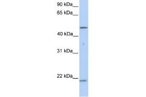 Cytokeratin 10 antibody used at 1 ug/ml to detect target protein. (Keratin 10 antibody)