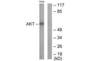 Western blot analysis of extracts from NIH/3T3 cells, treated with Insulin (0.