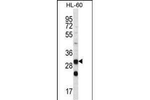 CA6 Antibody (C-term) (ABIN656592 and ABIN2845853) western blot analysis in HL-60 cell line lysates (35 μg/lane).