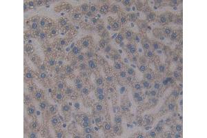 Figure. (Hemopexin antibody  (AA 235-378))