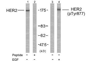 Western blot analysis of extract from MDA-MB-231 cells treated or untreated with EGF using HER2 (Ab-877) Antibody (E021070, Line 1 and 2) and HER2 (phospho-Tyr877) antibody (E011075, Line 3 and 4). (ErbB2/Her2 antibody  (pTyr877))