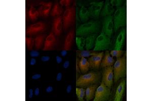 ABIN7094434 and ABIN7098482 staining  cells by IF/ICC. (FURIN antibody  (N-Term))