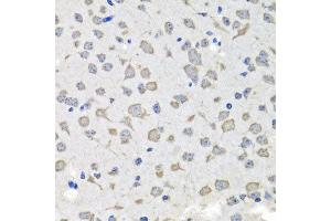 Immunohistochemistry of paraffin-embedded mouse brain using C1GALT1C1 antibody at dilution of 1:100 (x40 lens). (C1GALT1C1 antibody)