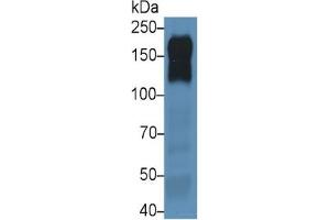 Mouse Capture antibody from the kit in WB with Positive Control: Sample Human A431 cell lysate;. (EGFR ELISA Kit)