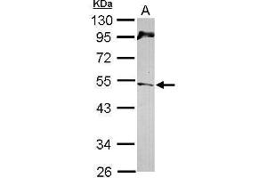 WB Image Sample (30 ug of whole cell lysate) A: NT2D1 10% SDS PAGE antibody diluted at 1:1000 (CHEK1 antibody  (C-Term))