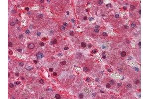 Immunohistochemical analysis of paraffin-embedded human Liver tissues using LPA antibody (Apo(a) antibody)