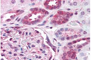 Human Kidney (formalin-fixed, paraffin-embedded) stained with RELA antibody ABIN218583 at 1:500 followed by biotinylated goat anti-rabbit IgG secondary antibody ABIN481713, alkaline phosphatase-streptavidin and chromogen. (NF-kB p65 antibody  (C-Term))