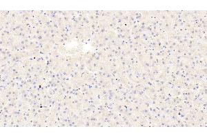 Detection of TRPA1 in Human Liver Tissue using Polyclonal Antibody to Transient Receptor Potential Cation Channel Subfamily A, Member 1 (TRPA1) (TRPA1 antibody  (AA 63-370))