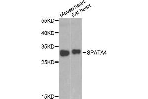 Western blot analysis of extracts of mouse heart and rat heart cell lines, using SPATA4 antibody.