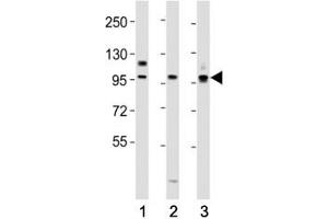 Western Blotting (WB) image for anti-Prospero Homeobox 1 (PROX1) (AA 492-520) antibody (ABIN3032345)