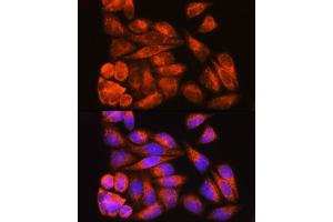 Immunofluorescence analysis of HeLa cells using ODF2 Rabbit pAb (ABIN7269128) at dilution of 1:100. (ODF2 antibody  (AA 630-829))
