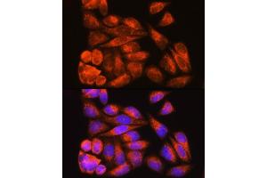 Immunofluorescence analysis of HeLa cells using ODF2 Rabbit pAb (ABIN7269128) at dilution of 1:100. (ODF2 antibody  (AA 630-829))