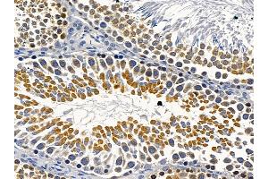 ABIN6264586 and ABIN6279745 at 1/100 staining rat testis tissue by IHC-P. (RAB5B antibody  (C-Term))