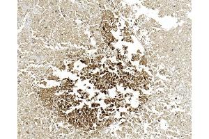 Immunohistochemical analysis of paraffin-embedded Human pancreas section using Pink1 (ABIN6244274 and ABIN6577058). (ENO2/NSE antibody)