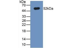 Detection of Recombinant FPN, Human using Monoclonal Antibody to Ferroportin (FPN) (SLC40A1 antibody  (AA 127-321))