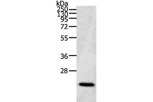 Western Blot analysis of Human fetal brain tissue using CDC42 Polyclonal Antibody at dilution of 1:200 (CDC42 antibody)