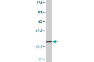 Western Blot detection against Immunogen (35. (PHACTR3 antibody  (AA 92-179))