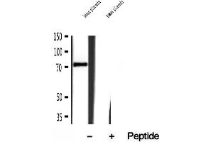 Western blot analysis of extracts of human placenta tissue, using Kindlin 2 antibody. (FERMT2 antibody  (C-Term))