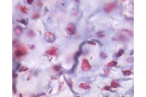 Anti-PTHR / PTHR1 antibody IHC of human bone, fractured callus. (PTH1R antibody  (Internal Region))