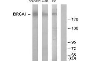 Western blot analysis of extracts from COLO205/HepG2 cells, treated with serum 20% 15', using BRCA1 (Ab-1524) Antibody.