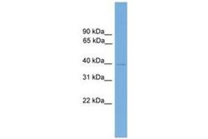 FOXB2 antibody  (AA 341-390)