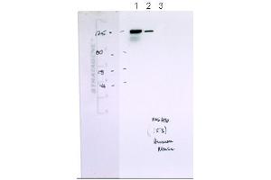 MSH6 antibody - N-terminal region  validated by WB using Human B cells and Mouse B cells at 0.
